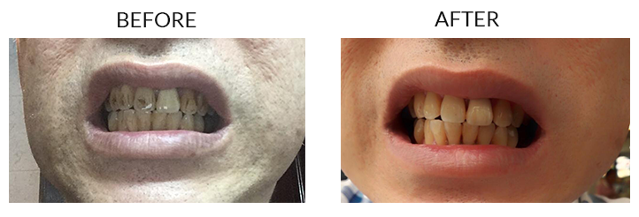Kenny Oral Botanica Teeth Whitener